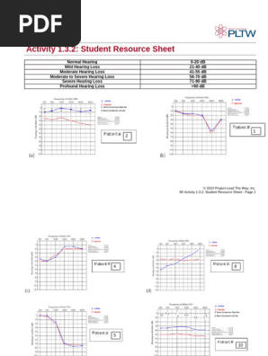 audiogram