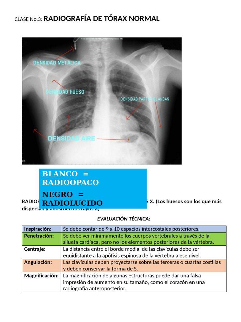 Radiografía de Tórax Normal: Guía Clínica | PDF | Pulmón | Tórax