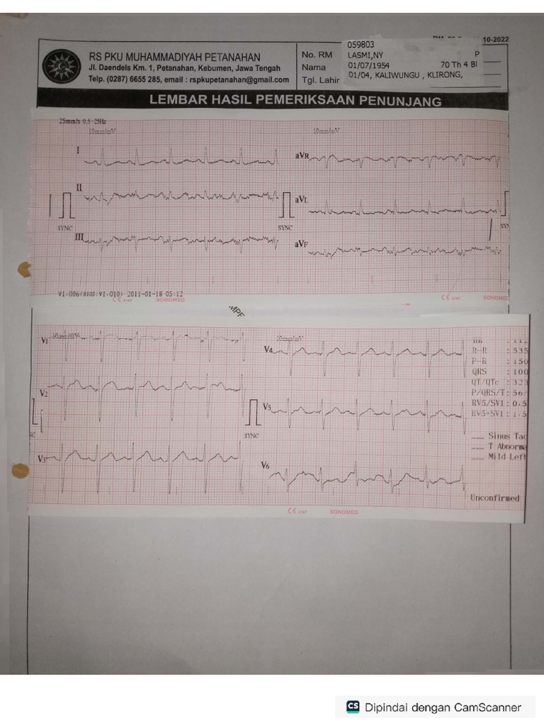 Ny. Lasmi Ekg | PDF