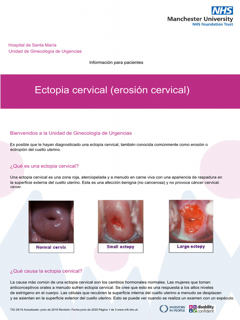Ectopia cervical y sangrado en embarazo | PDF | El embarazo | Cáncer