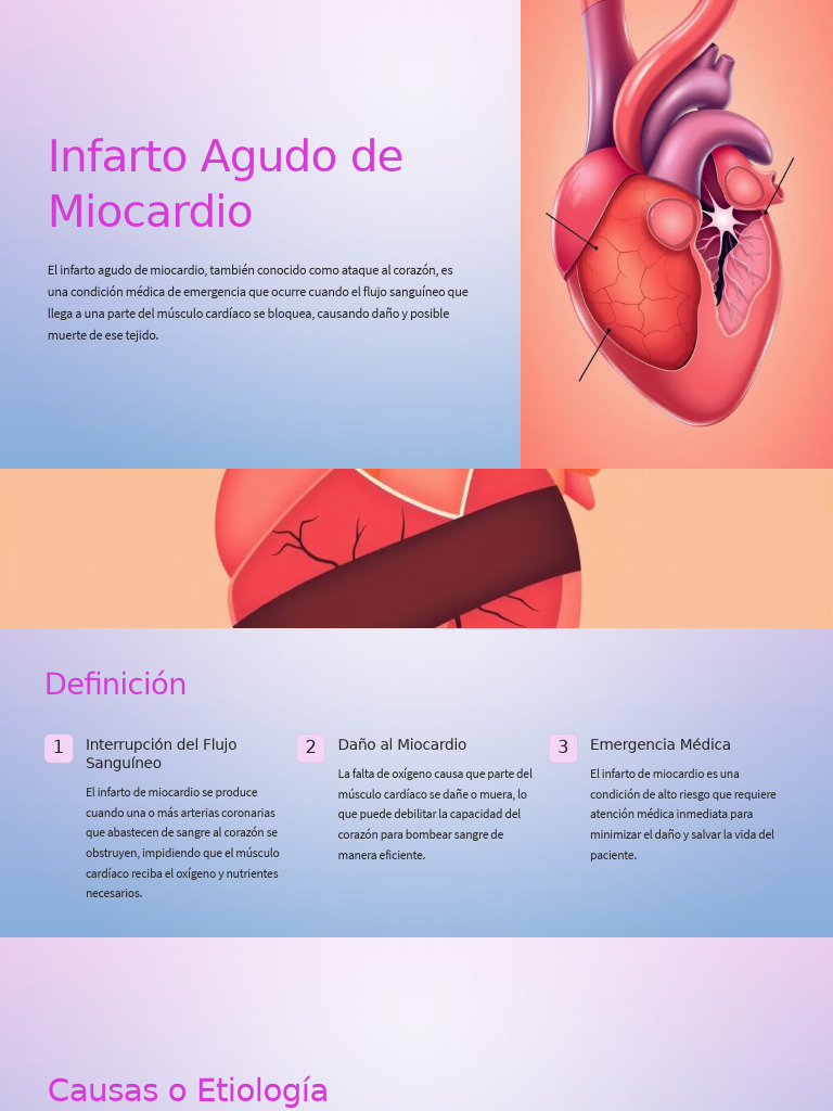 Infarto Agudo: Causas y Tratamiento | PDF | Infarto de miocardio ...