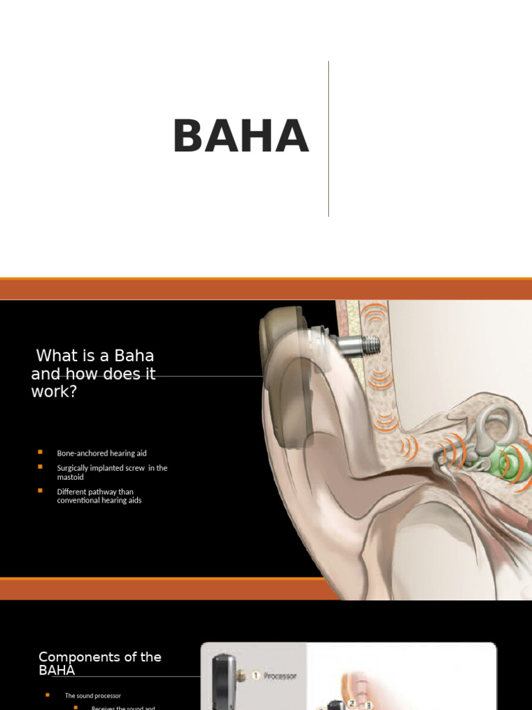 Understanding Bone-Anchored Hearing Aids | PDF | Hearing Loss ...