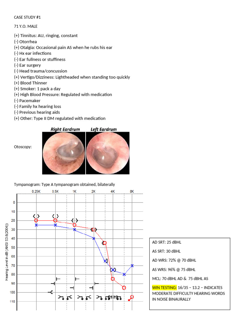 Case Studies | PDF | Vertigo | Ear