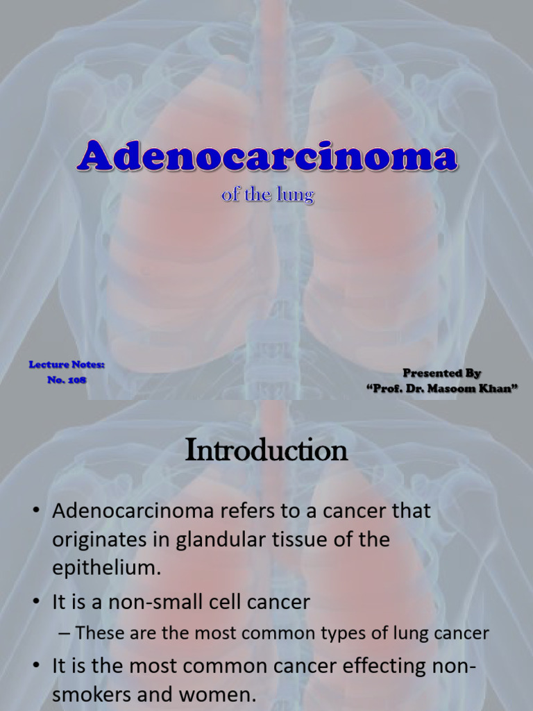 Adenocarcinoma of The Lung | PDF | Lung Cancer | Cancer