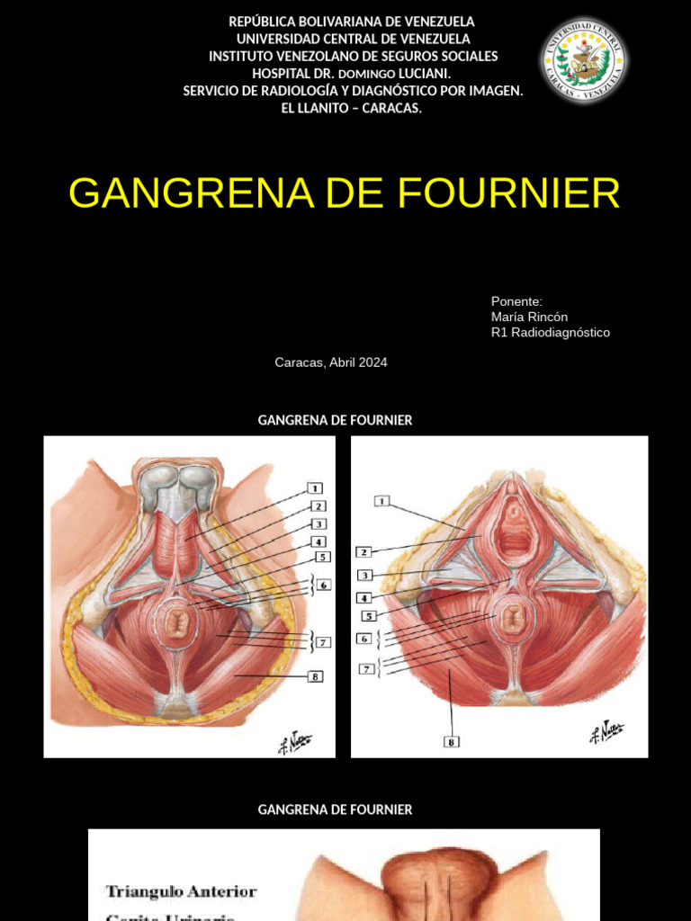 Gangrena de Fournier | PDF