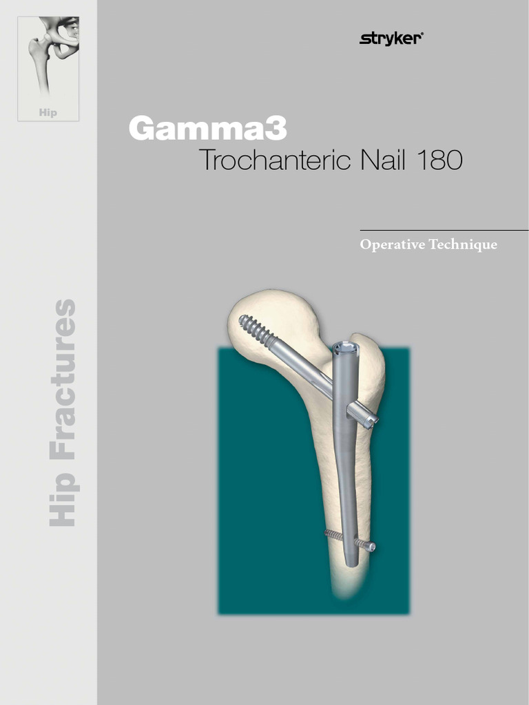 TFN-ADVANCED Proximal Femoral Nailing System (TFNA), image size:768x1024