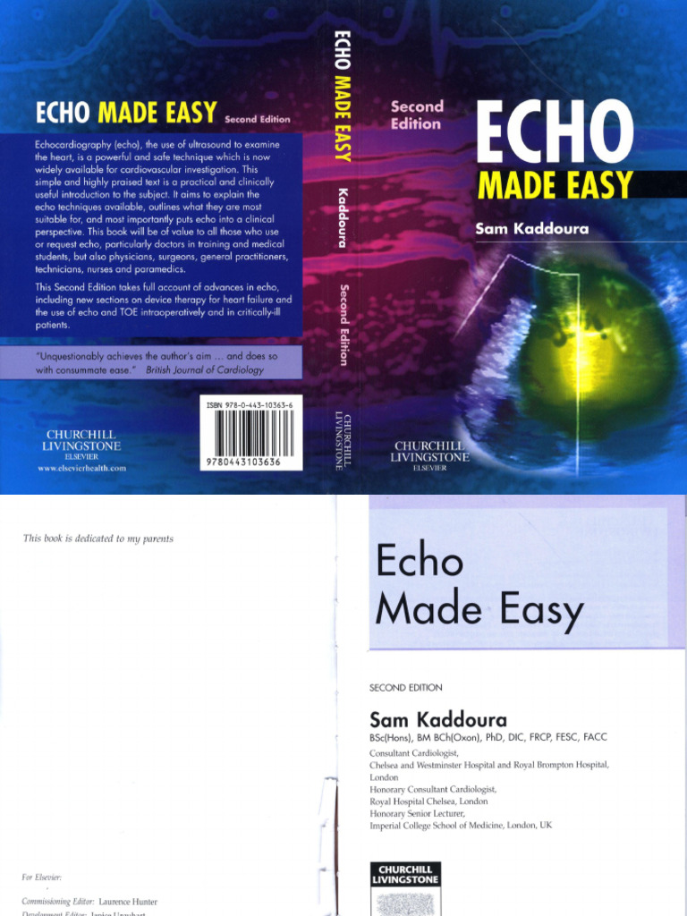 Echo Made Easy | PDF