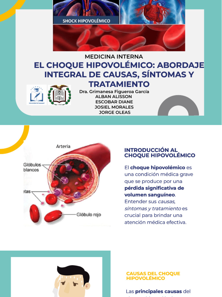 Choque Hipovolemico | PDF