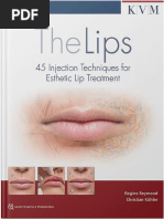 The Lips-45 Injection Techniques For Esthetic Lip Treatment