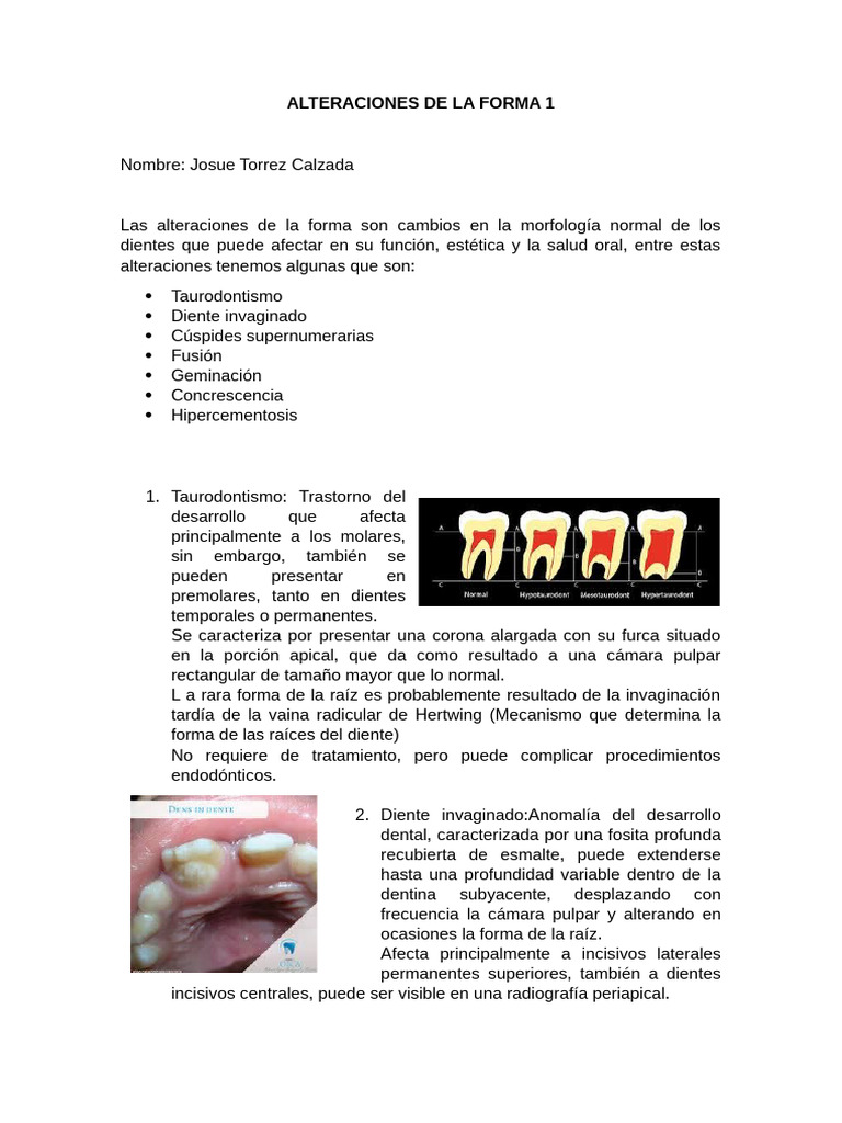 Alteraciones de La Forma 1 | PDF | Diente | Ramas de Odontología