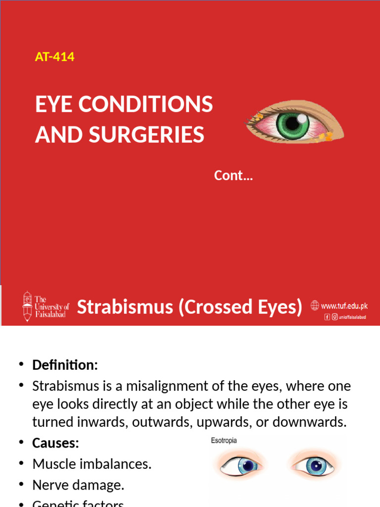 Eye Surgery Conditions (Class Notes) | PDF | Human Eye | Clinical Medicine