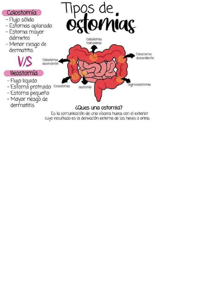Imprimir Ostomia | PDF