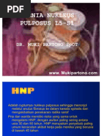 Download Hernia Nukleus Pulposus l5-s1 by laindunia SN79205893 doc pdf