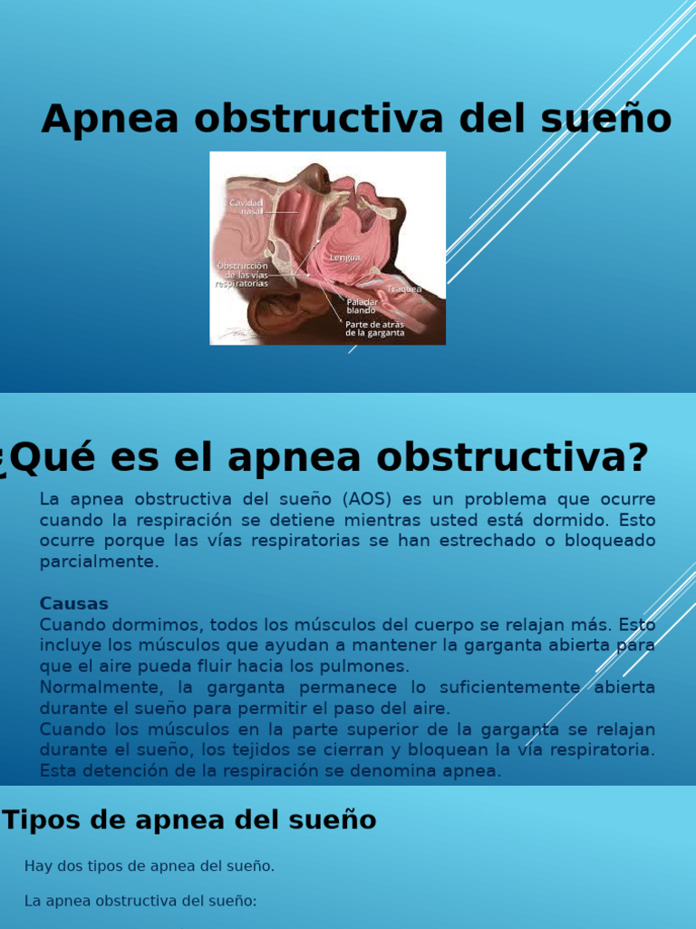 Cómo diagnosticar la apnea del sueño en tu bebé, image size:768x1024