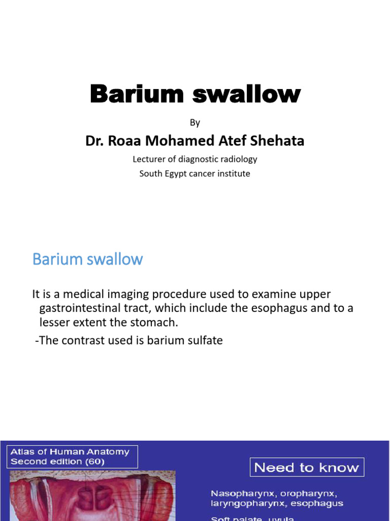 Barium Swallow Procedure Overview | PDF