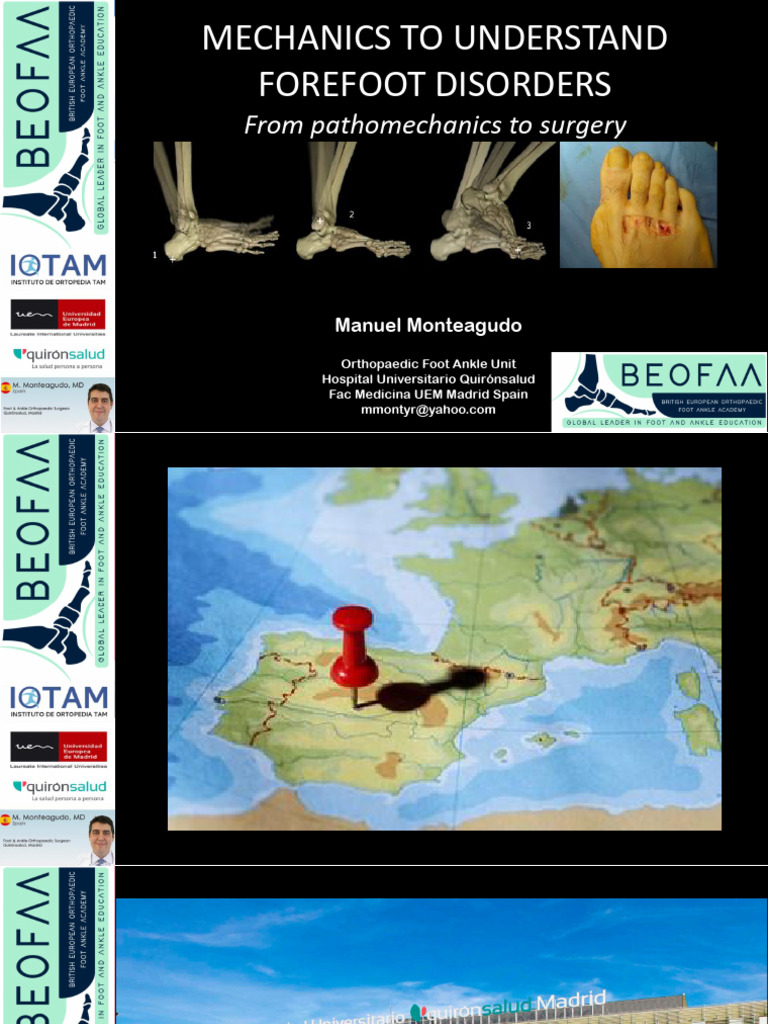 MECHANICS TO UNDERSTAND FOREFOOT DISORDERS Monteagudo | PDF | Foot | Ankle