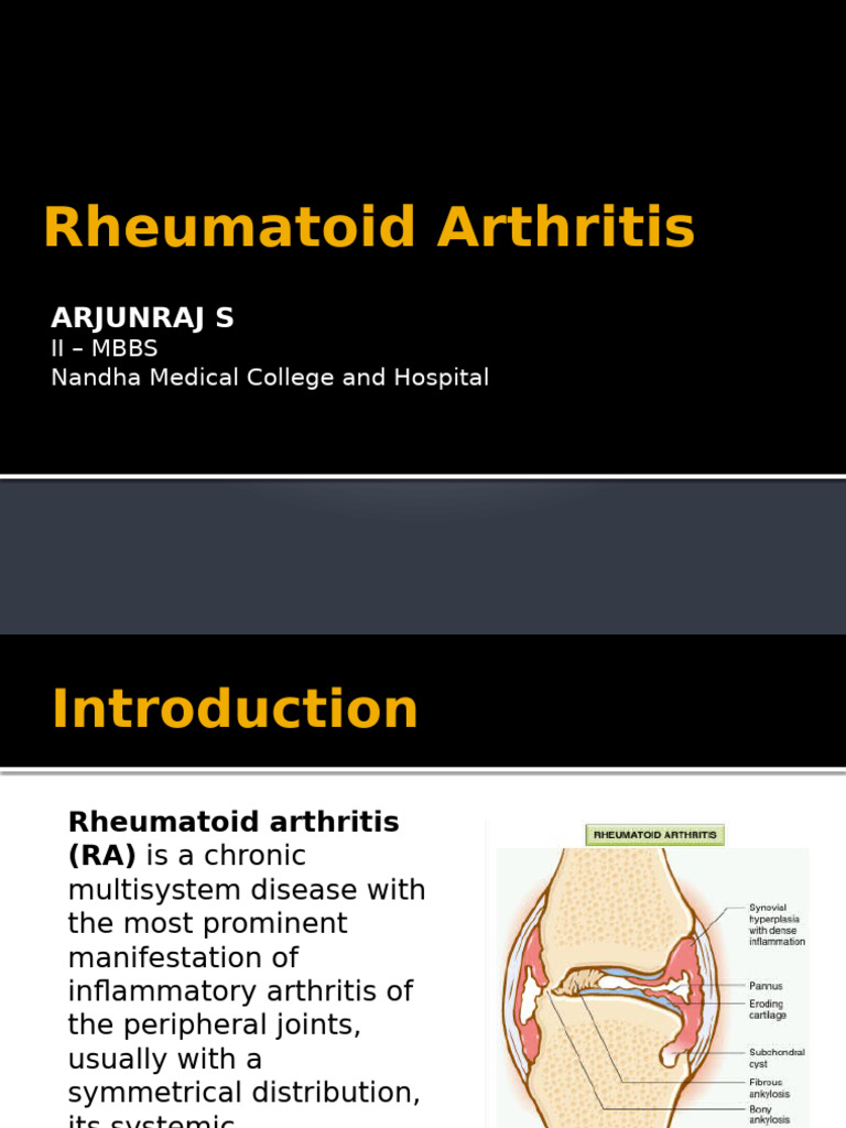 Rheumatoid Arthritis 2 | PDF | Rheumatoid Arthritis | Arthritis