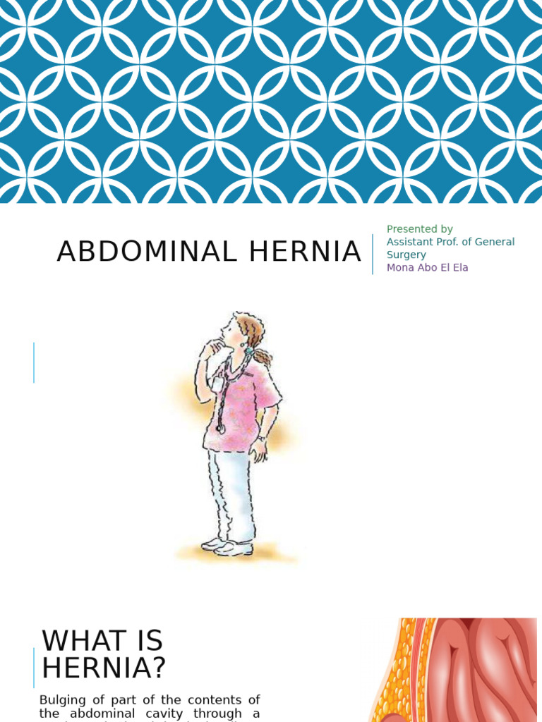Management of Large Abdominal Hernias | PDF | Abdomen