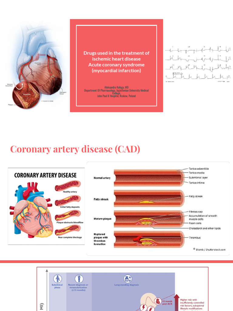 Ischemic Heart Disease Drug Treatments | PDF | Myocardial Infarction ...