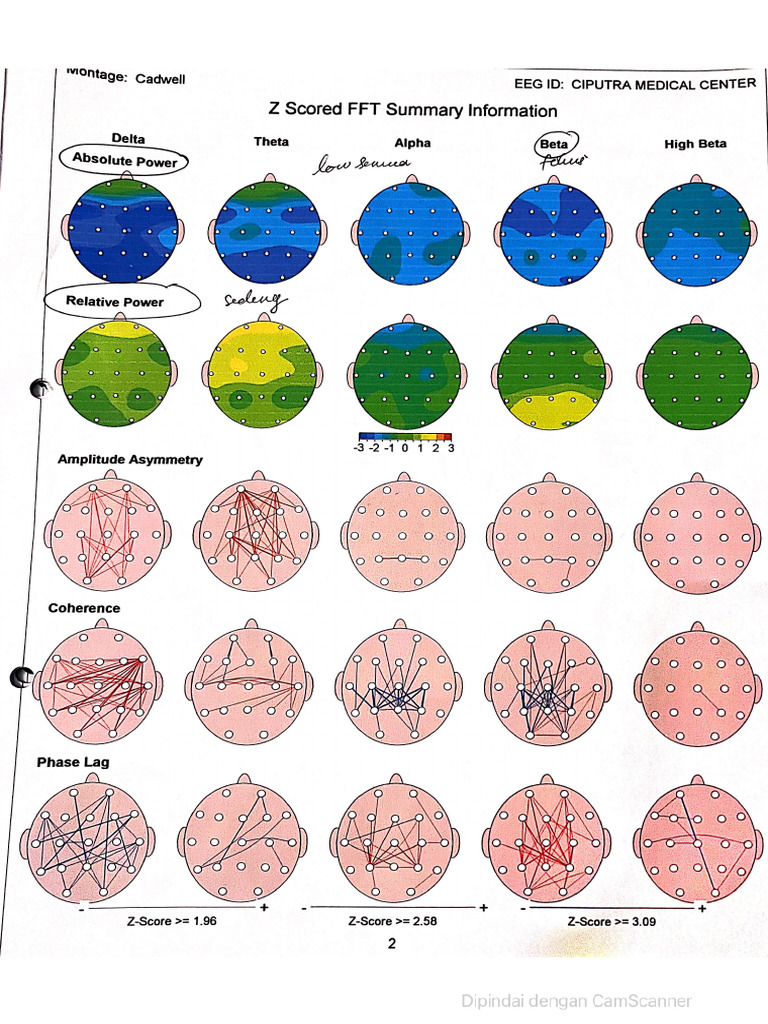 Brainmap | PDF