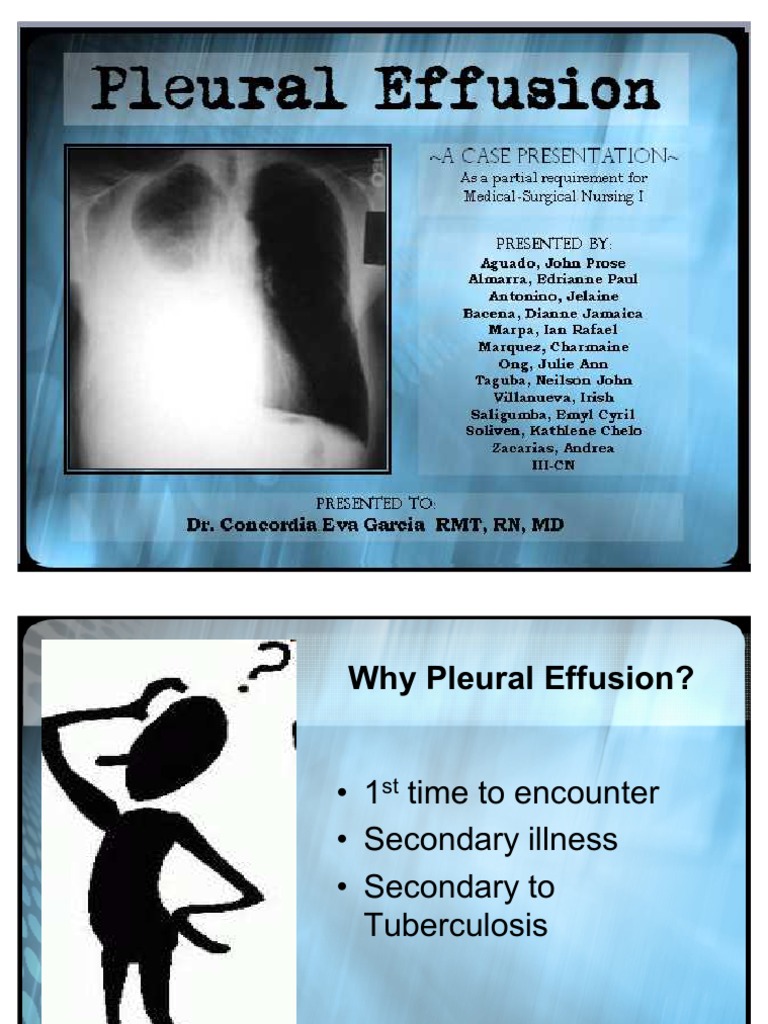 Pleural Effusion Ppt | Lung | Medicine