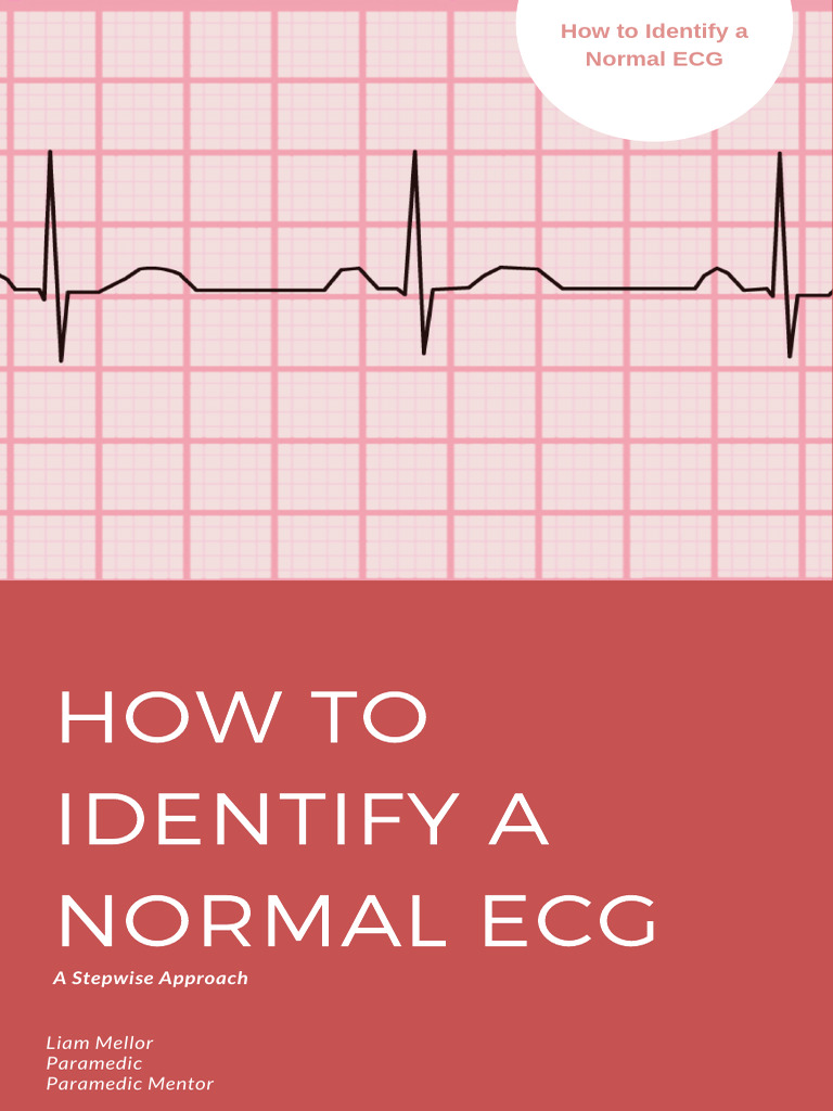 Identifying a Normal ECG: A Guide | PDF | Electrocardiography ...