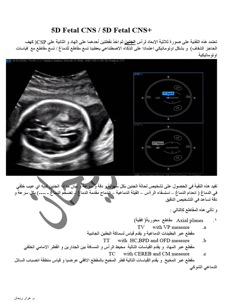 5D Fetal CNS / 5D Fetal CNS+ | PDF