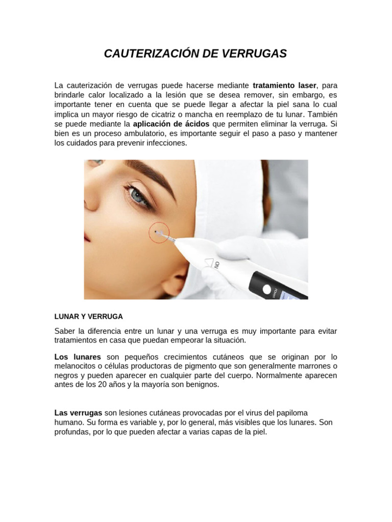 Cauterización y Diagnóstico de Verrugas | PDF | Melanoma | Piel