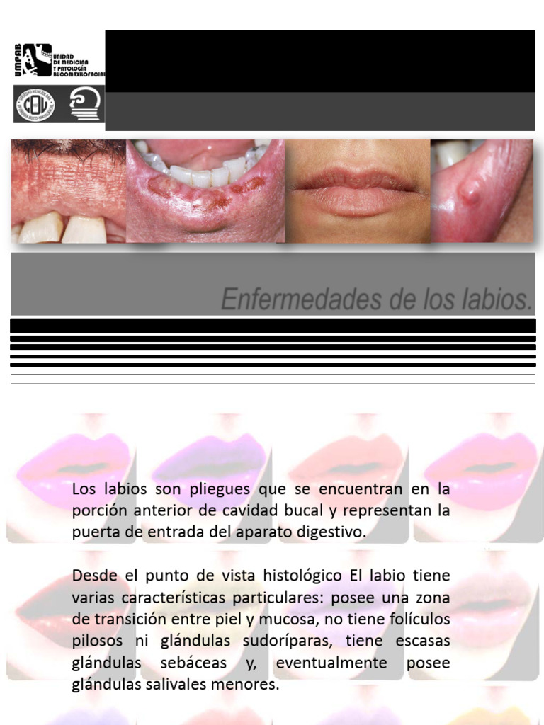 Enfermedad de Los Labios | PDF | Candidiasis | Labio