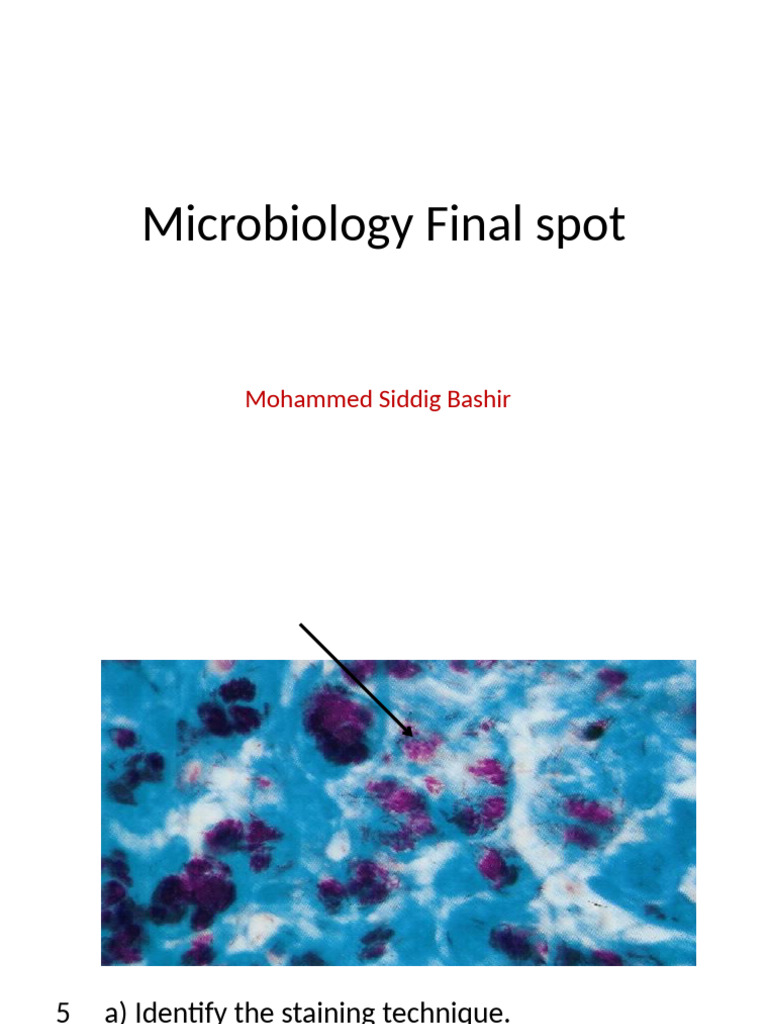 Microbiology Exam Review: Key Concepts | PDF | Bacteria | Diseases And ...