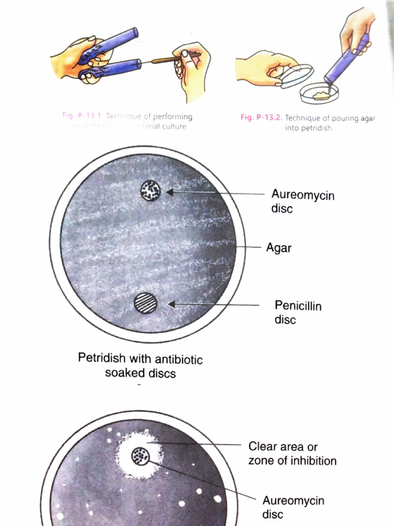 Antibiotic Disc Diffusion Technique | PDF | Science & Mathematics