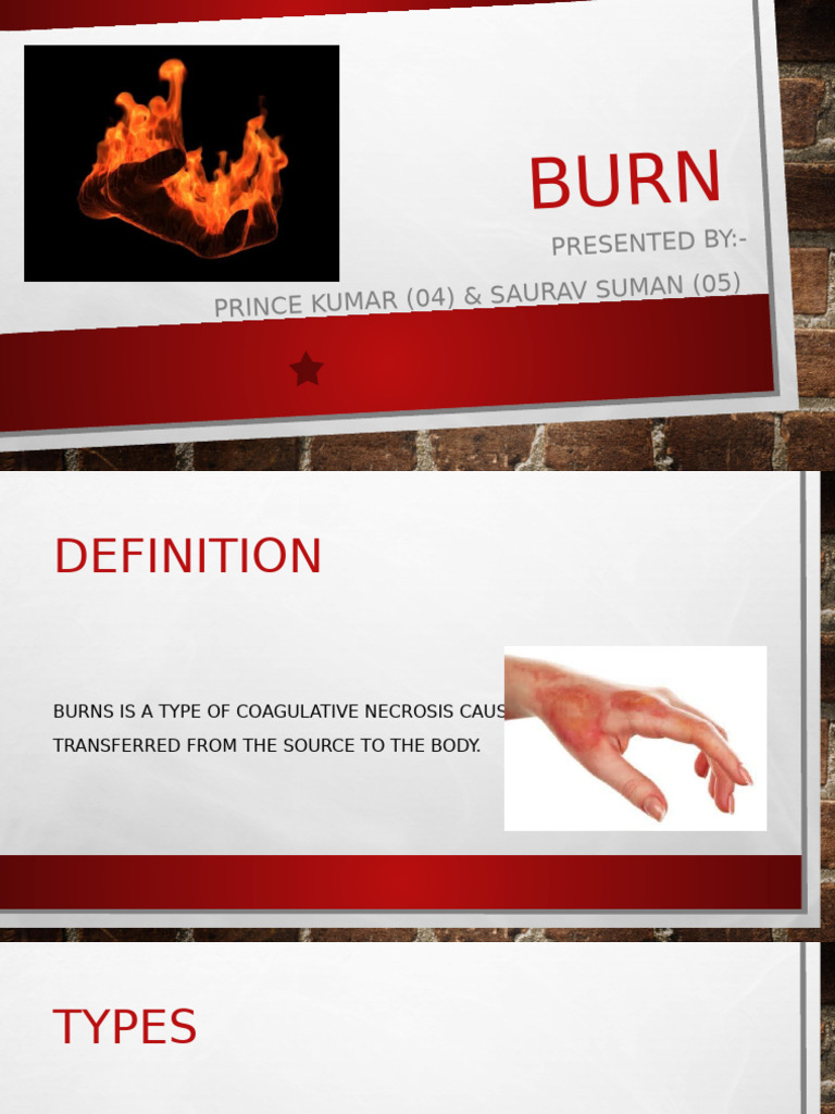 Burn Presentation 1 | PDF | Burn | Respiratory Tract
