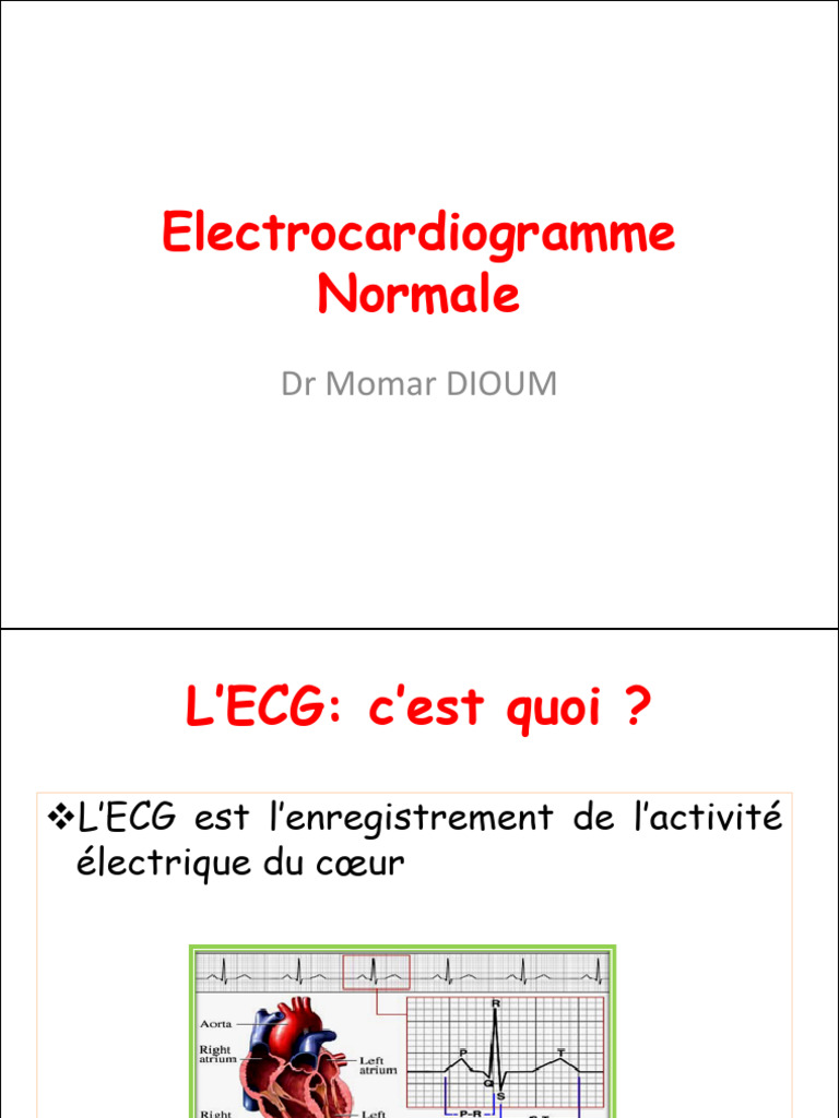 Interprétation de l'électrocardiogramme | PDF | Électrocardiographie ...