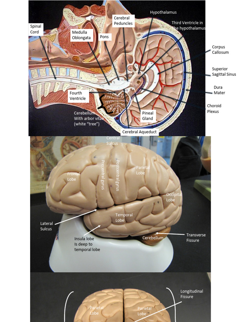 Nervous - Brain - Labeled Class Pack | PDF | Cerebral Hemisphere | Cerebrum