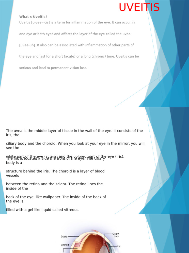 Group 1 Uveitis | PDF | Eye | Human Eye