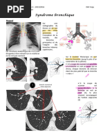 Comprendre le bronchogramme aérique | PDF | Système respiratoire | Thorax