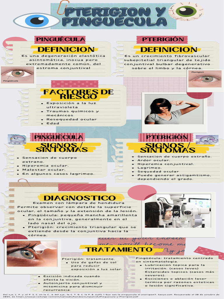 Pterigion y Piguecula | PDF | Enfermedades y trastornos ...