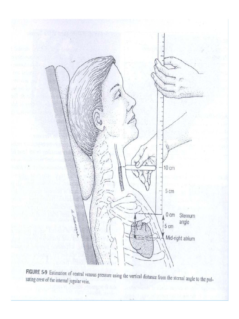 Gambar JVP | PDF