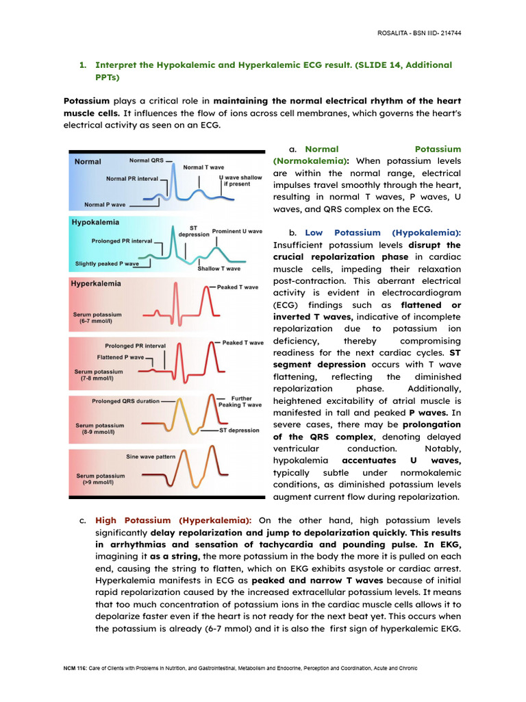 ECG Analysis of Potassium Levels | PDF | Hyperthyroidism | Lethal Injection