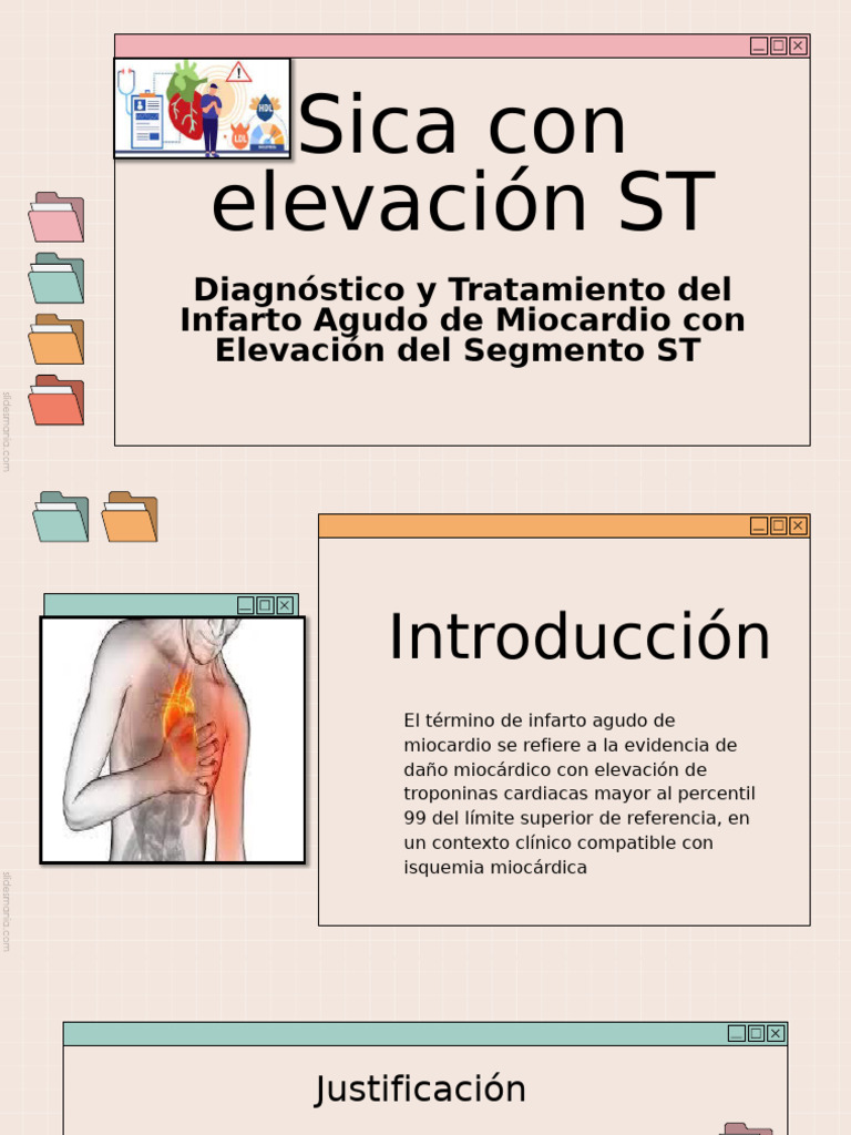 Zika Con Elevacion ST | PDF | Infarto de miocardio | Medicina CLINICA