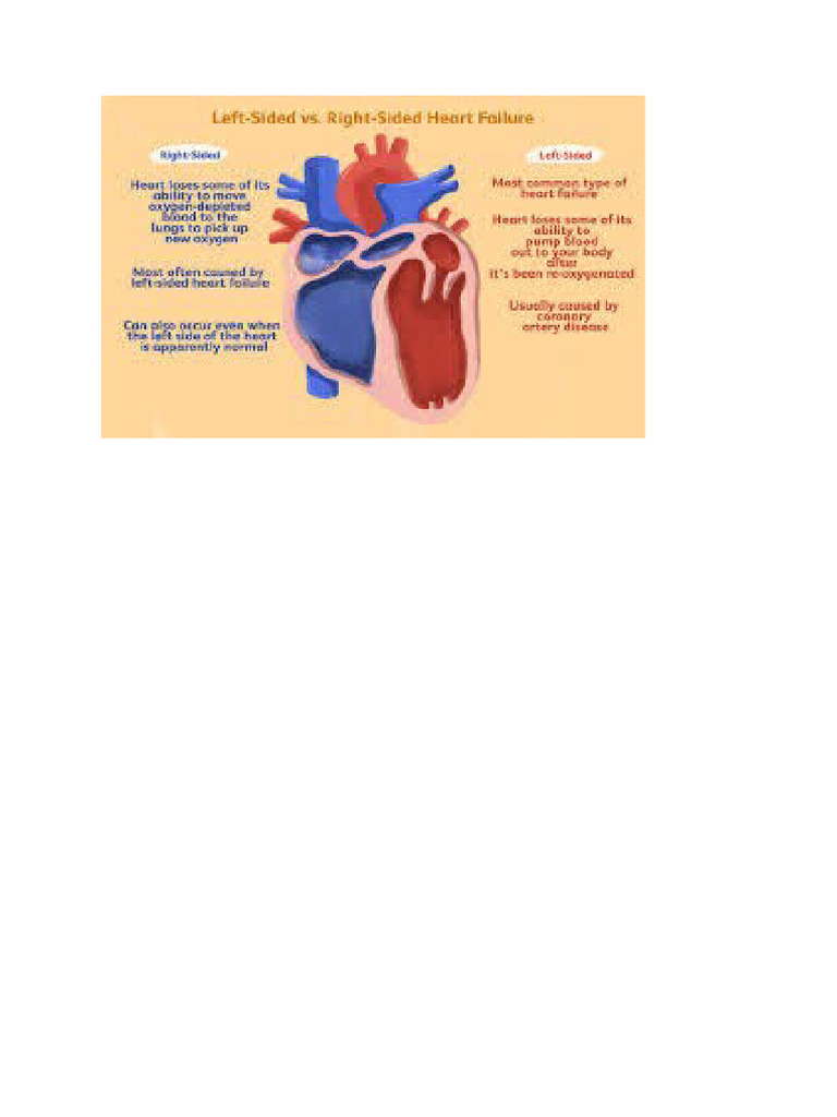 Heart Failure | PDF