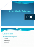 Arteritis de Takayasu