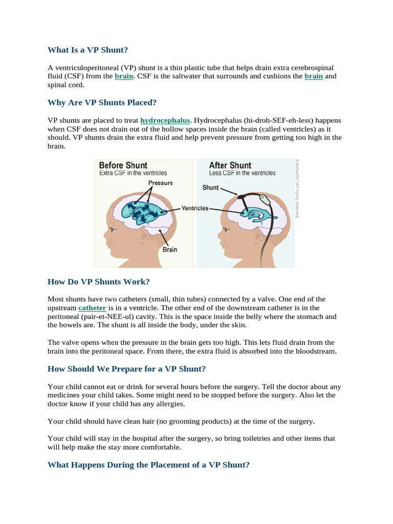 what-is-a-vp-shunt-pdf-surgery-cerebrospinal-fluid