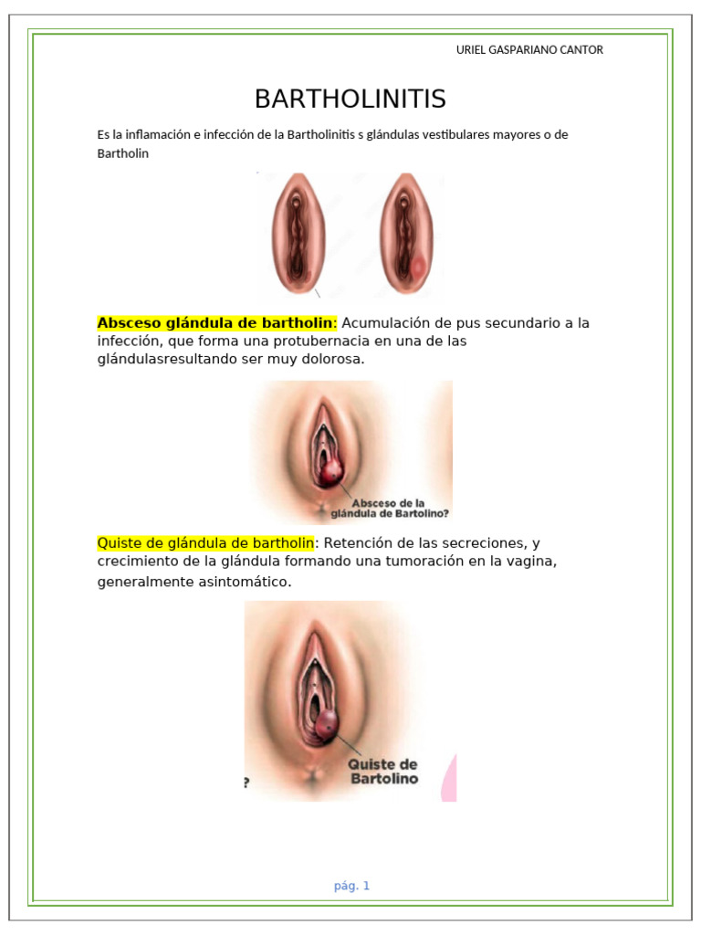 Bartholinitis | PDF | Ciencia y matemáticas