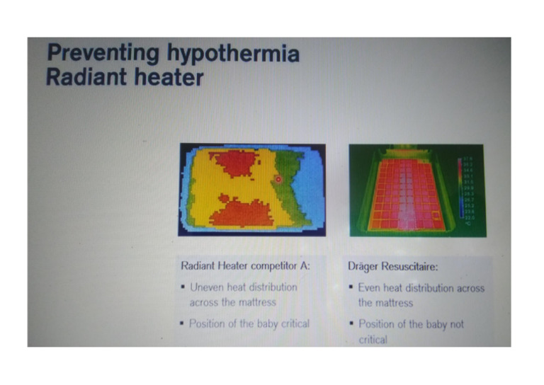 Hypothermia Pdf