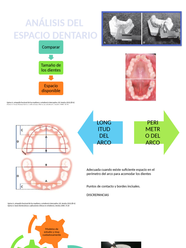 Analisis Modelos | PDF | Ortodoncia | Ramas de Odontología