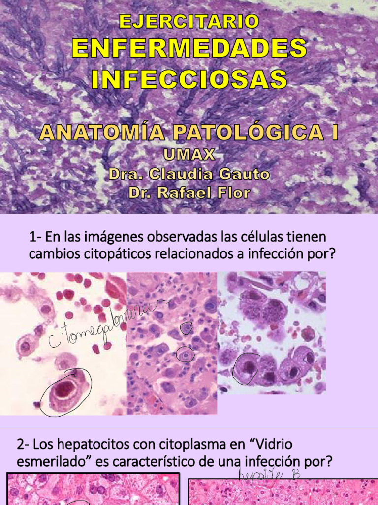 Ejercitario 4 - INFECTO | PDF | Causas de la muerte | Especialidades ...