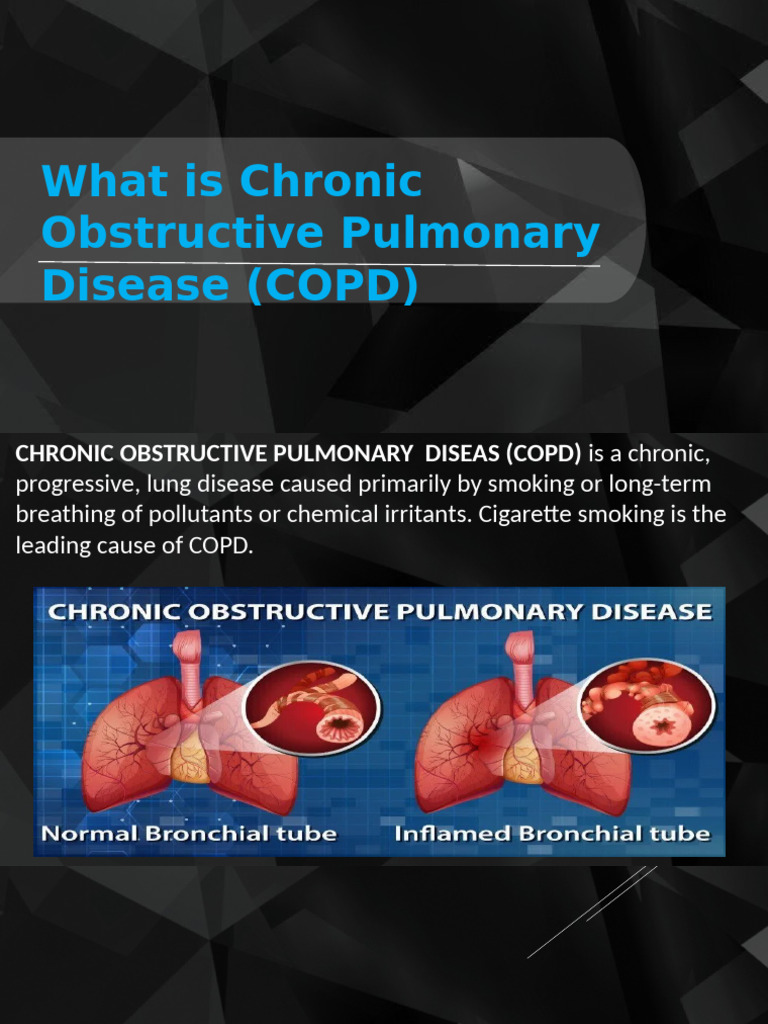 What Is Chronic Obstructive Pulmonary Disease (COPD) | PDF