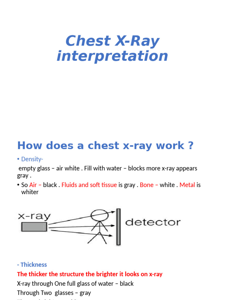 Chest Xray Interpertation | PDF