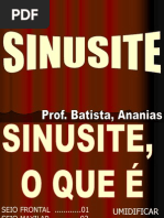 SINUSITE.pdf Alunos